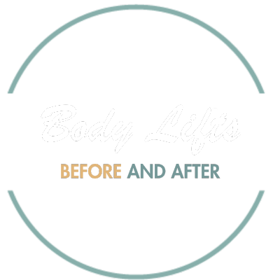 Body Lifts.png