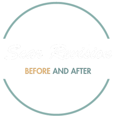 Scar hero text.png