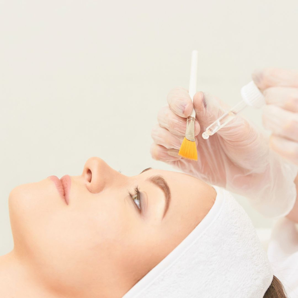 woman getting chemical peel treatment