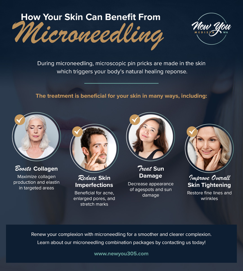 How Your Skin Can Benefit From Microneedling infographic
