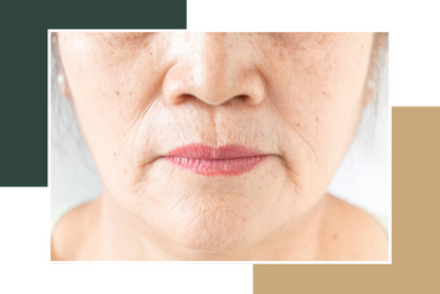 Facial Wrinkles.png