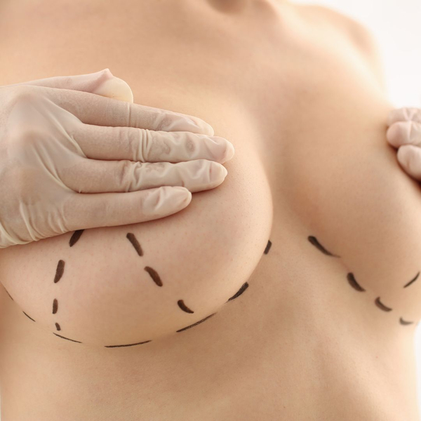 Breasts with markings on them
