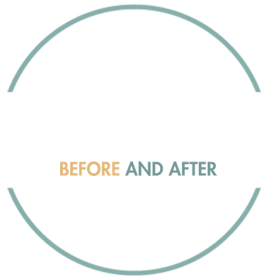 Neck Lipsuction.png