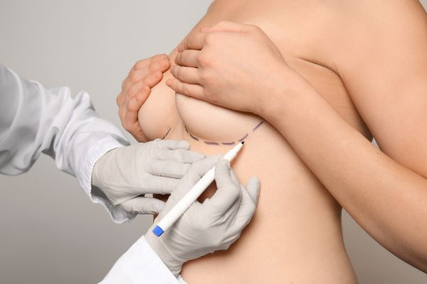 doctor marking bra