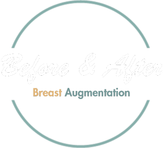 Before & After Breast Augmentation title