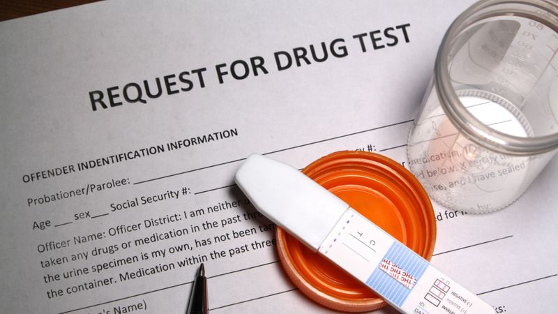 Drug test on top of a piece of paper that says "Request for Drug Test."