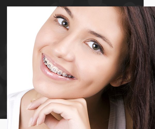 braces.jpg
