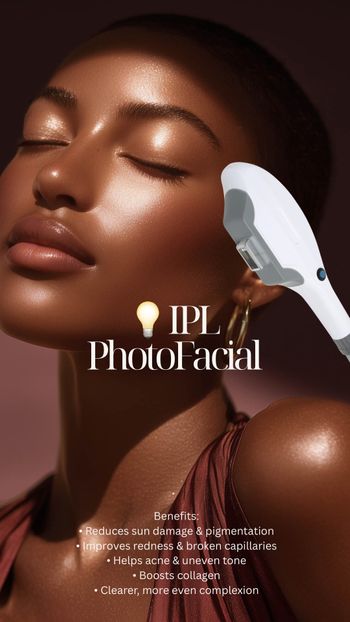 Copy of Christmas (Your Story).jpg