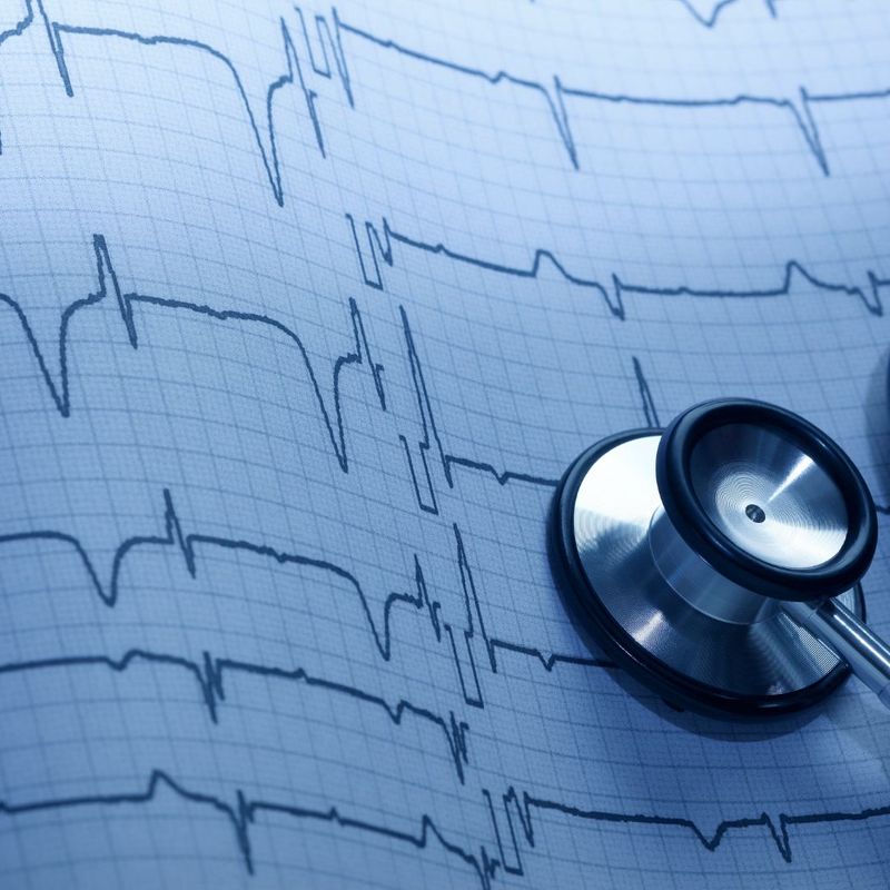 stethoscope on heartbeat chart