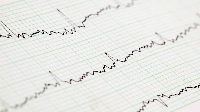 heartbeat chart