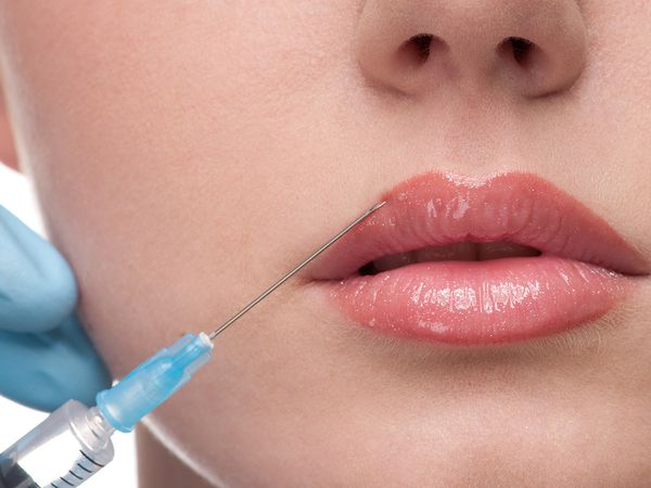 Image of a woman getting an injection into her lips