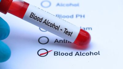 Blood Alcohol Test.