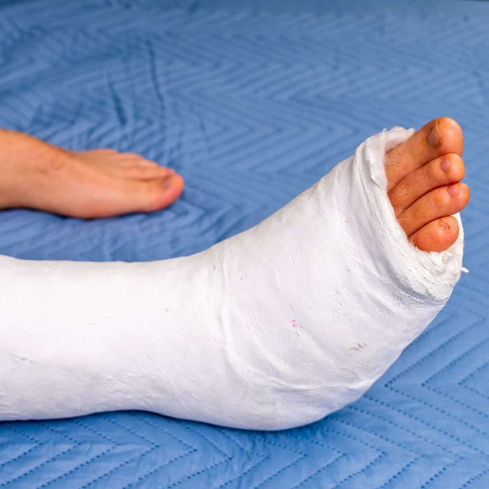 If Youve Had a Defective Product Injury You Can Take Legal Action - 4.jpg