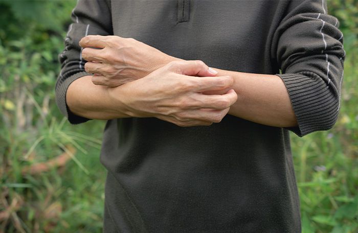 man with itchy skin outdoors