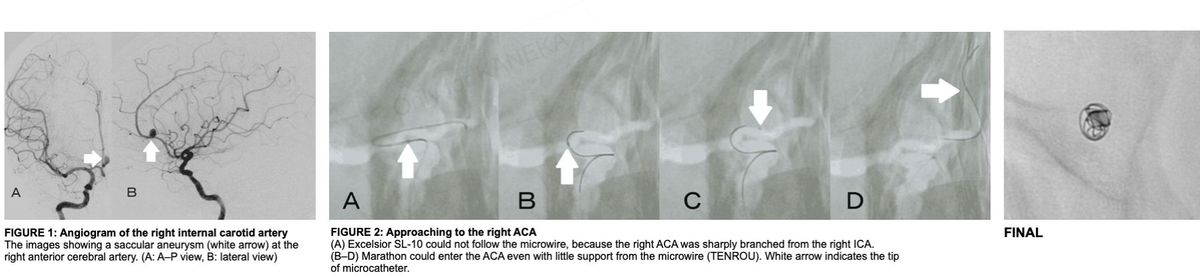 WaveSelect Wire case study.jpg