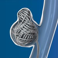 Complex Infiniti Coil