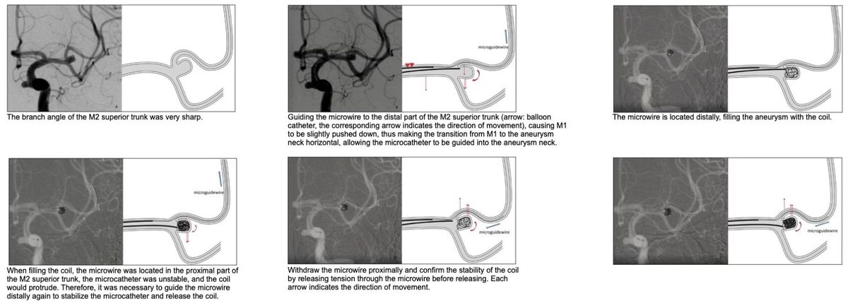 WaveSelect Wire (3).jpg