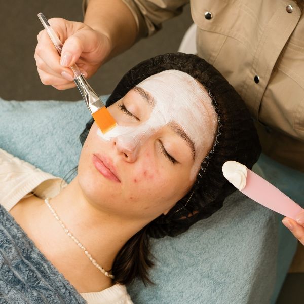 Woman receiving chemical peel treatment