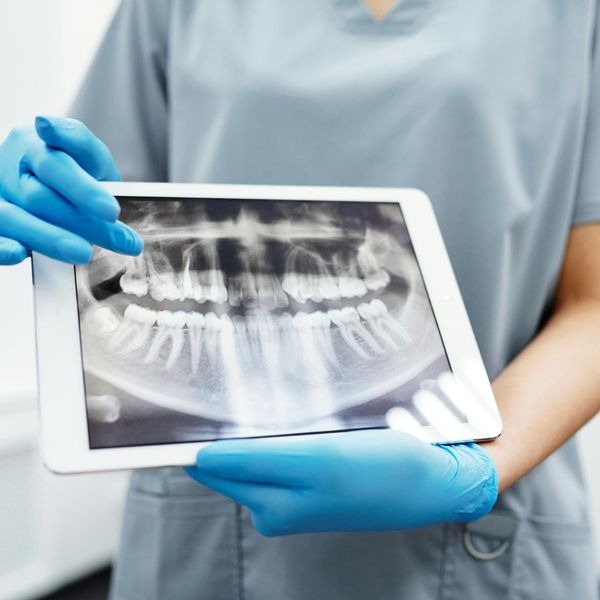 Xray of teeth. Xray of teeth.