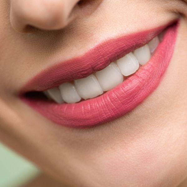 Straight, white teeth.