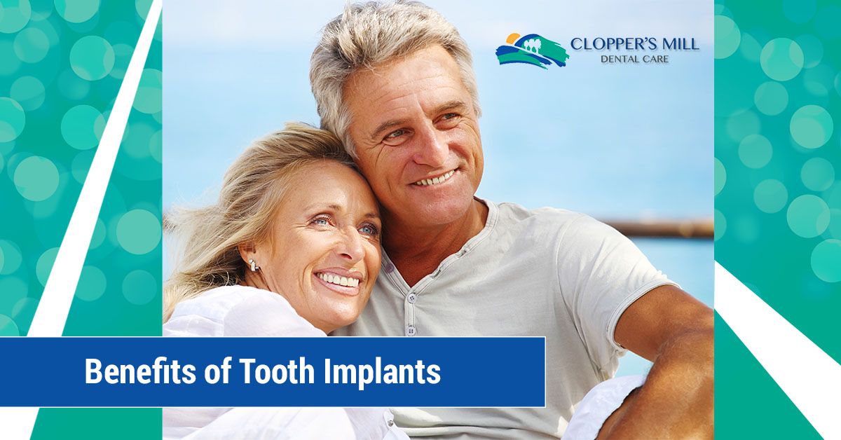 Benefits-of-Tooth-Implants-5b5743a5cbfac.jpg