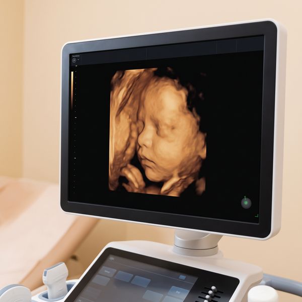 The Magic of Seeing Your Baby in 3D and 4D Ultrasounds-Image2.jpeg