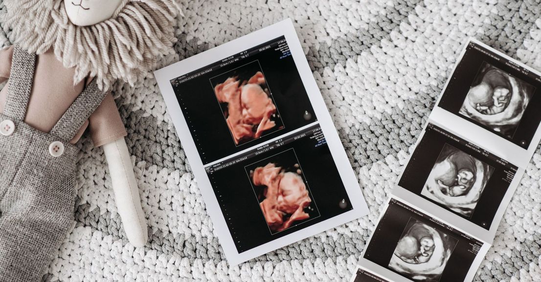 M27674 - Blog Article - What You Need to Know About Ultrasound 8K Image Enhancement - Hero.jpg