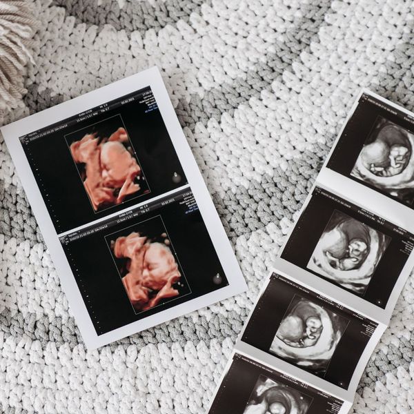 2 4 Ways 3D Ultrasounds Are Different From 2D.jpg