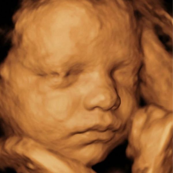 How to Prepare Your Toddler for Their New Sibling%E2%80%99s Ultrasound 4.jpg