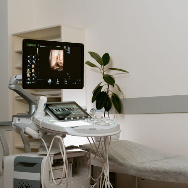 3d ultrasound