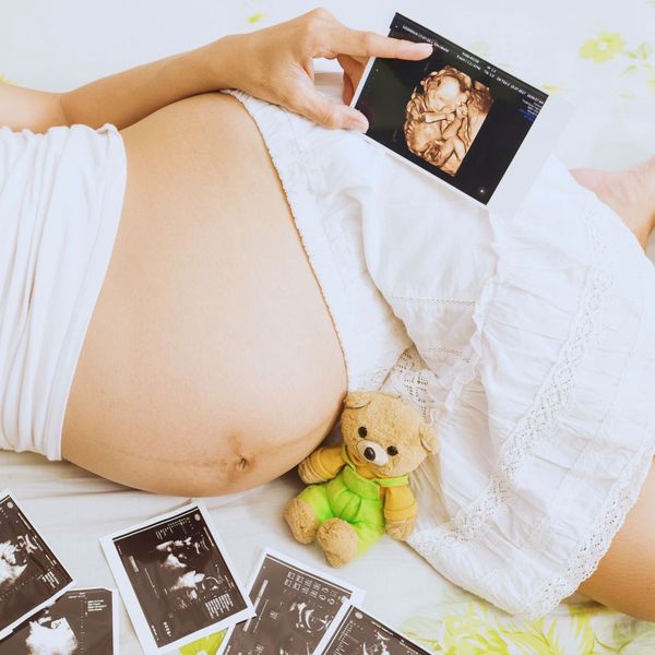 3 4 Ways 3D Ultrasounds Are Different From 2D.jpg