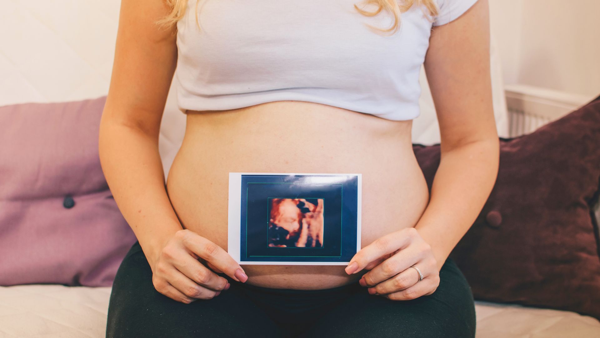 pregnant woman holding 3D ultrasound photo