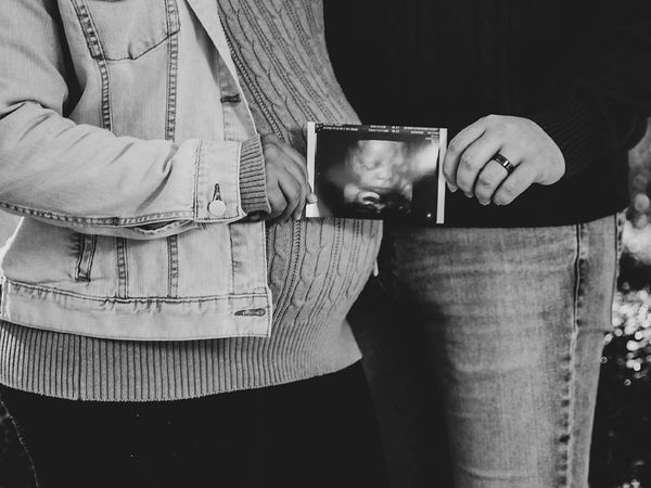 couple holding 3D image of baby ultrasound