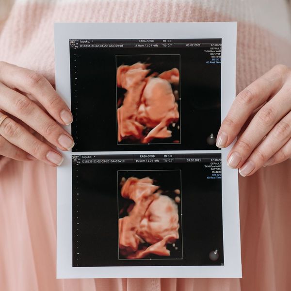 holding 4d ultrasound in front of belly holding 4d ultrasound in front of belly
