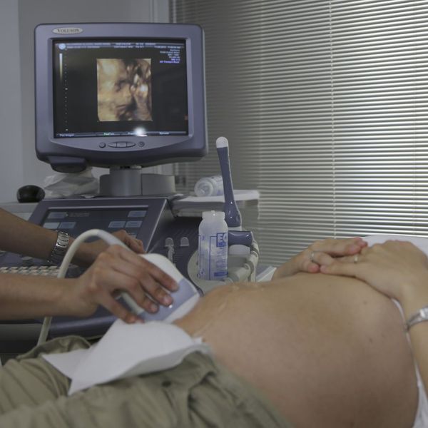 Mother getting an ultrasound