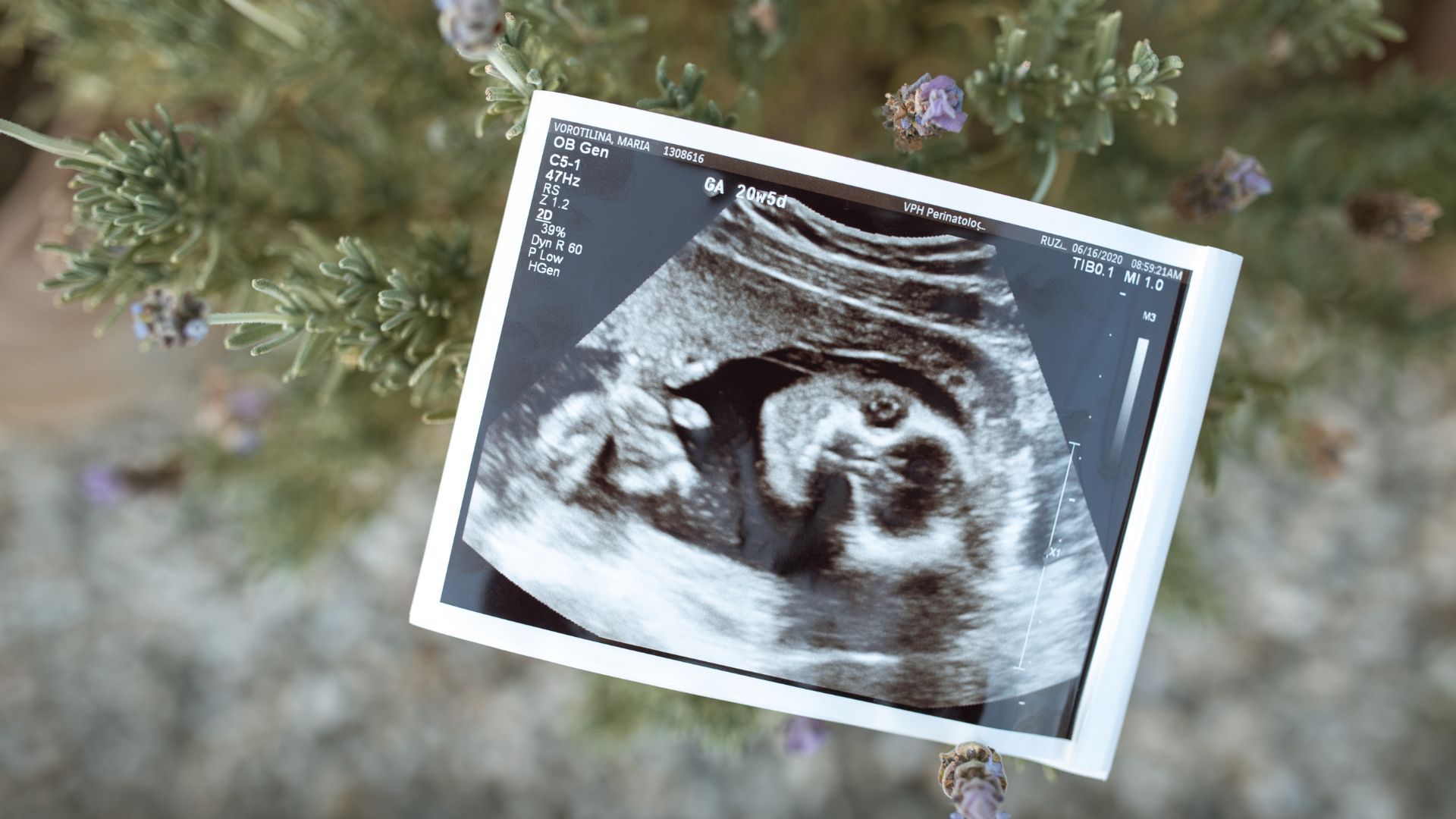 feature - Four Reasons You Should Go to a Clinic for Your Ultrasound.jpg