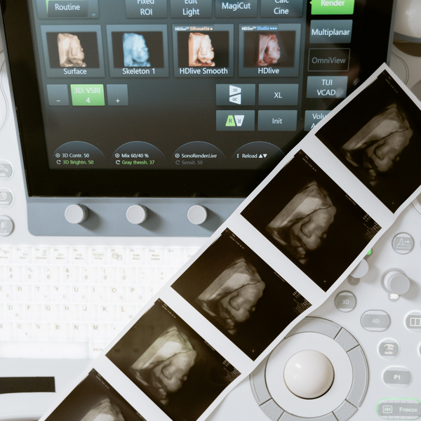 ultrasound pictures and ultrasound machine