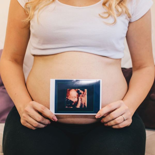 a woman holding a 3D ultrasound image in front of her belly