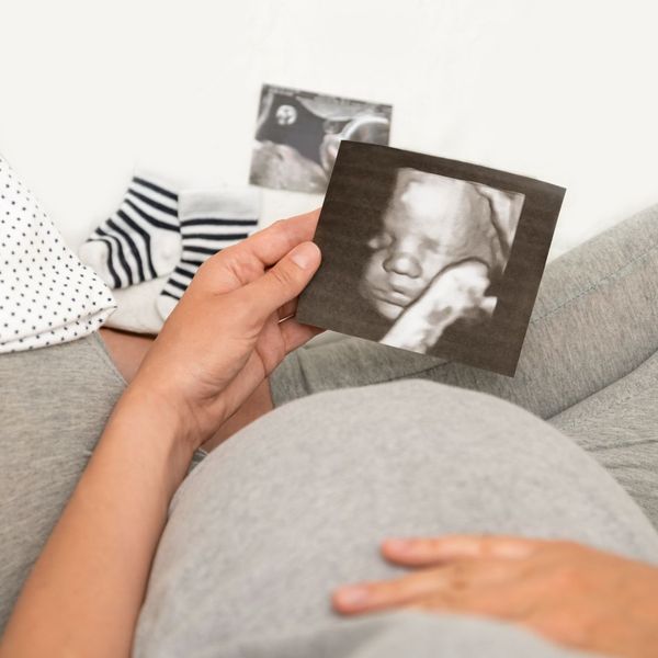 pregnant woman holding 3d ultrasound photo