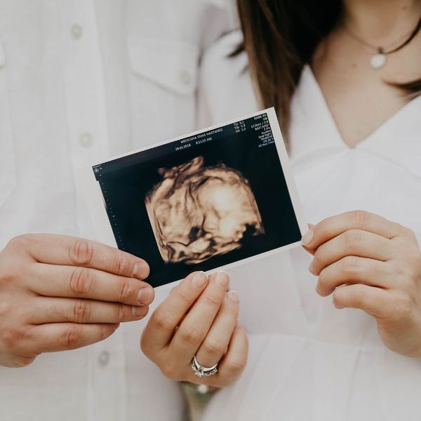 woman and man holding ultrasound image