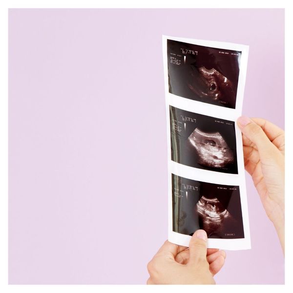 ultrasound images