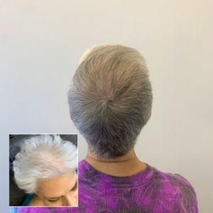 Womens white hair density treatment.jpg