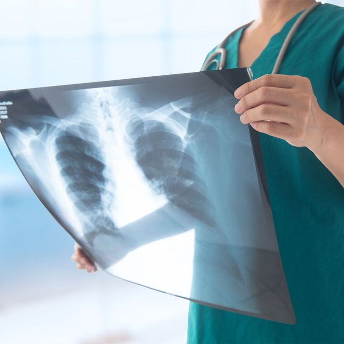 nurse holding x-ray