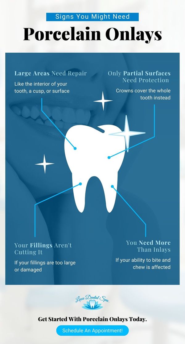M25887 - Luxe Dental Spa - Signs You Might Need Porcelain Onlays - Infographic.jpg