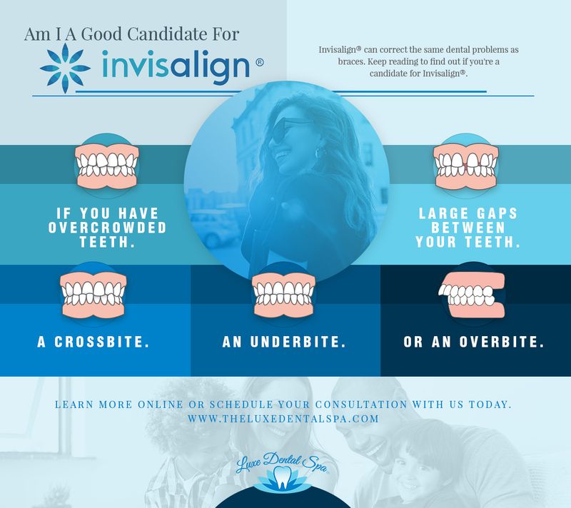 The 5 Most Commonly Asked Questions About Invisalign - Banff