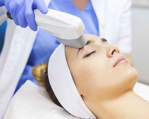 Image of a woman getting IPL treatment