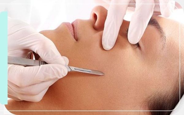 Dermaplaning - Image1.jpg