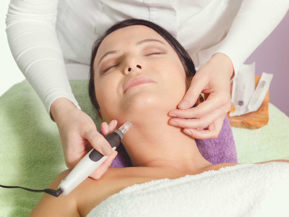 Microneedling 1.png
