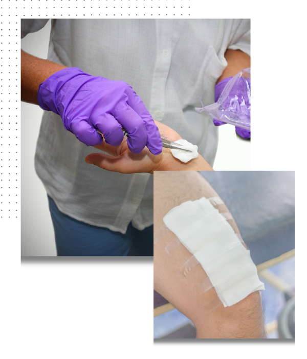 wound care