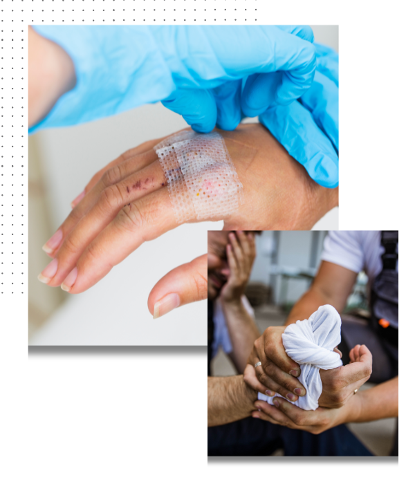 open wound dressing Calcium Alginate Dressing — Vive Health
